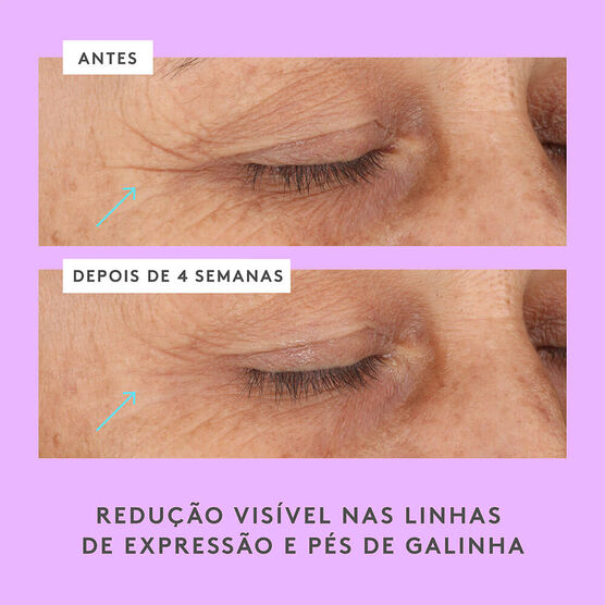 Ceramighty AF Eye Balm 15ml